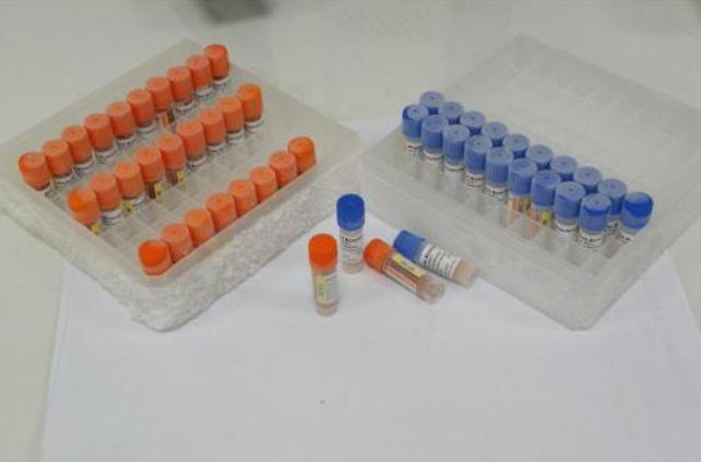 質控菌株的優勢以及保存注意事項介紹