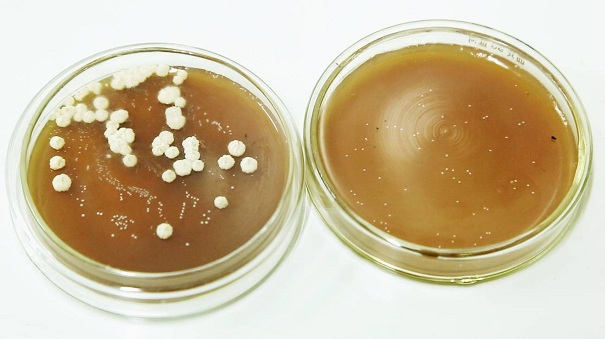 常見微生物菌種的種類有哪些？它應該這樣去進行保存！