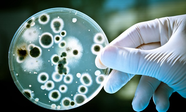 對于微生物菌種認知上有哪些誤區？選擇它的技巧一起了解一下！